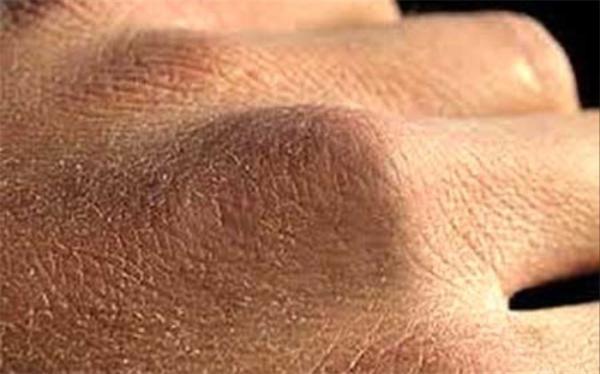 تاثیر مصرف خوراکی ها بر رنگ پوست تاثیر مصرف خوراکی ها بر رنگ پوست