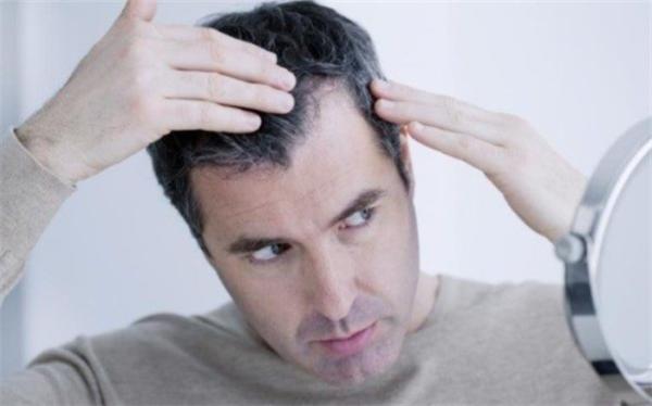 چرا نباید موهای سفید را از ریشه کند چرا نباید موهای سفید را از ریشه کند