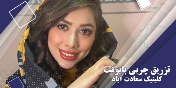 مزایای بایوفت، جدیدترین تکنیک تزریق چربی در ایران مزایای بایوفت، جدیدترین تکنیک تزریق چربی در ایران